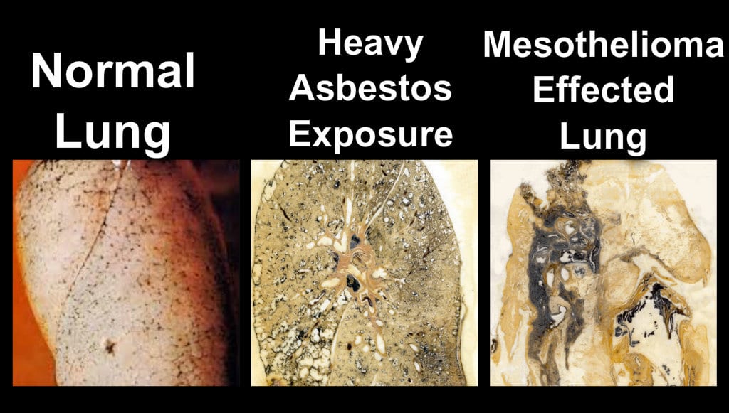 asbestos removal services in Mississauga ontario