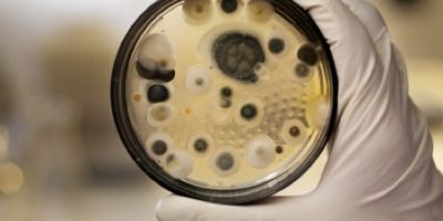 20 Interesting Things About Mold